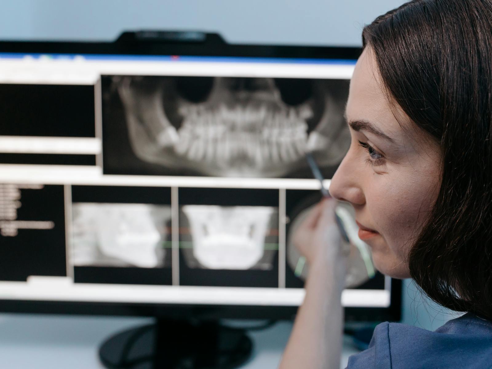 Analiza pantomogramu oraz przekrojów tomografii CBCT na monitorze w pracowni rentgenowskiej