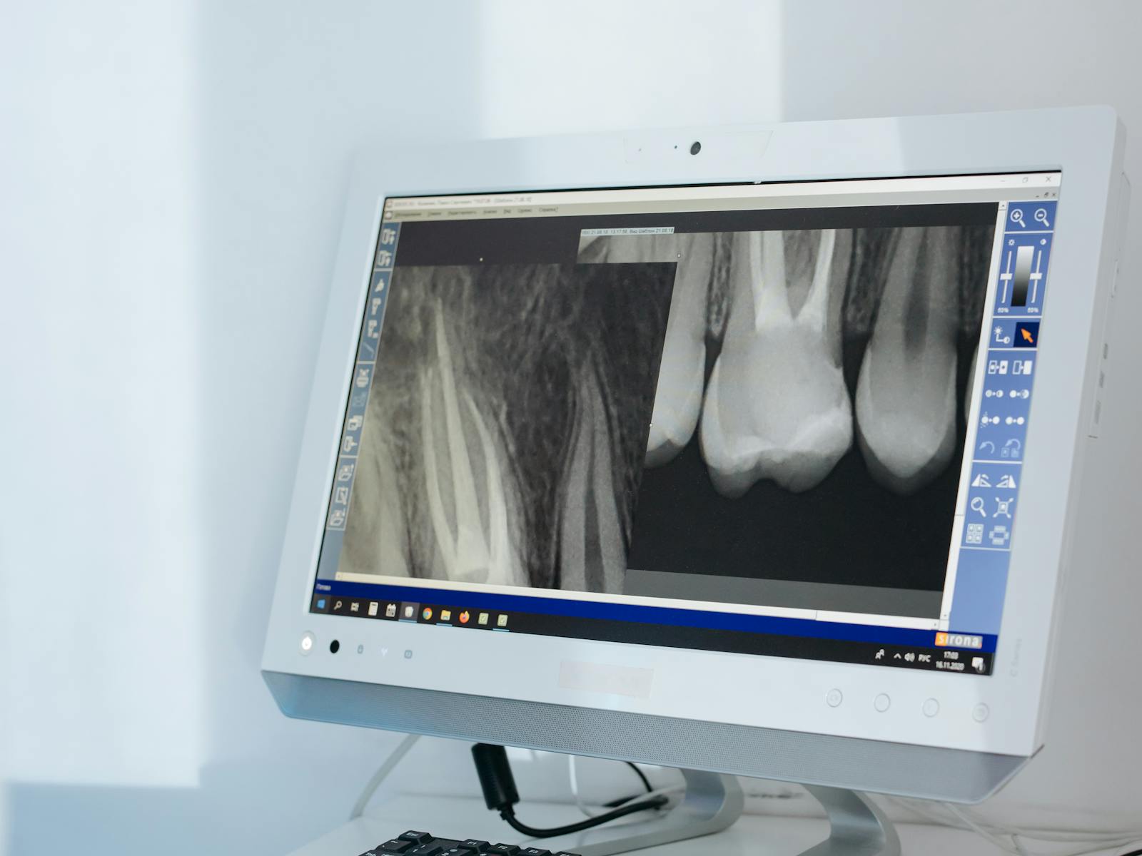 Zdjęcie rentgenowskie zębów na monitorze w gabinecie stomatologicznym