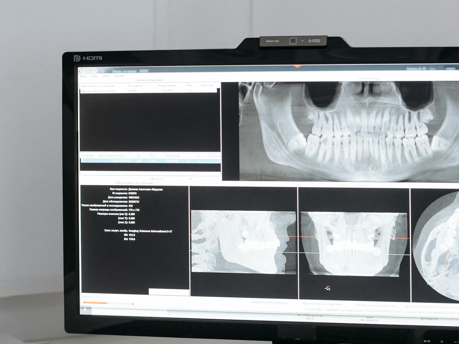Pantomogram oraz przekroje CBCT widoczne na monitorze pracowni rentgenowskiej